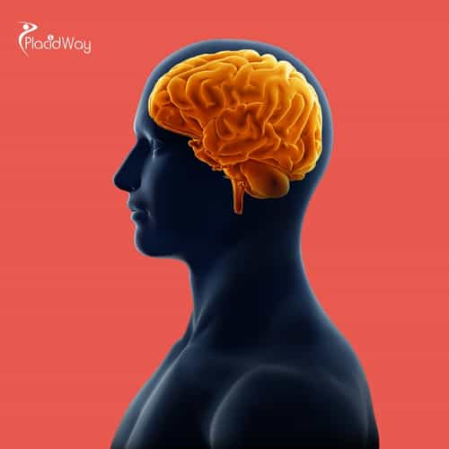 Tratamiento con células madre para neurología en Colombia para pacientes del Reino Unido que buscan restaurar su salud cerebral